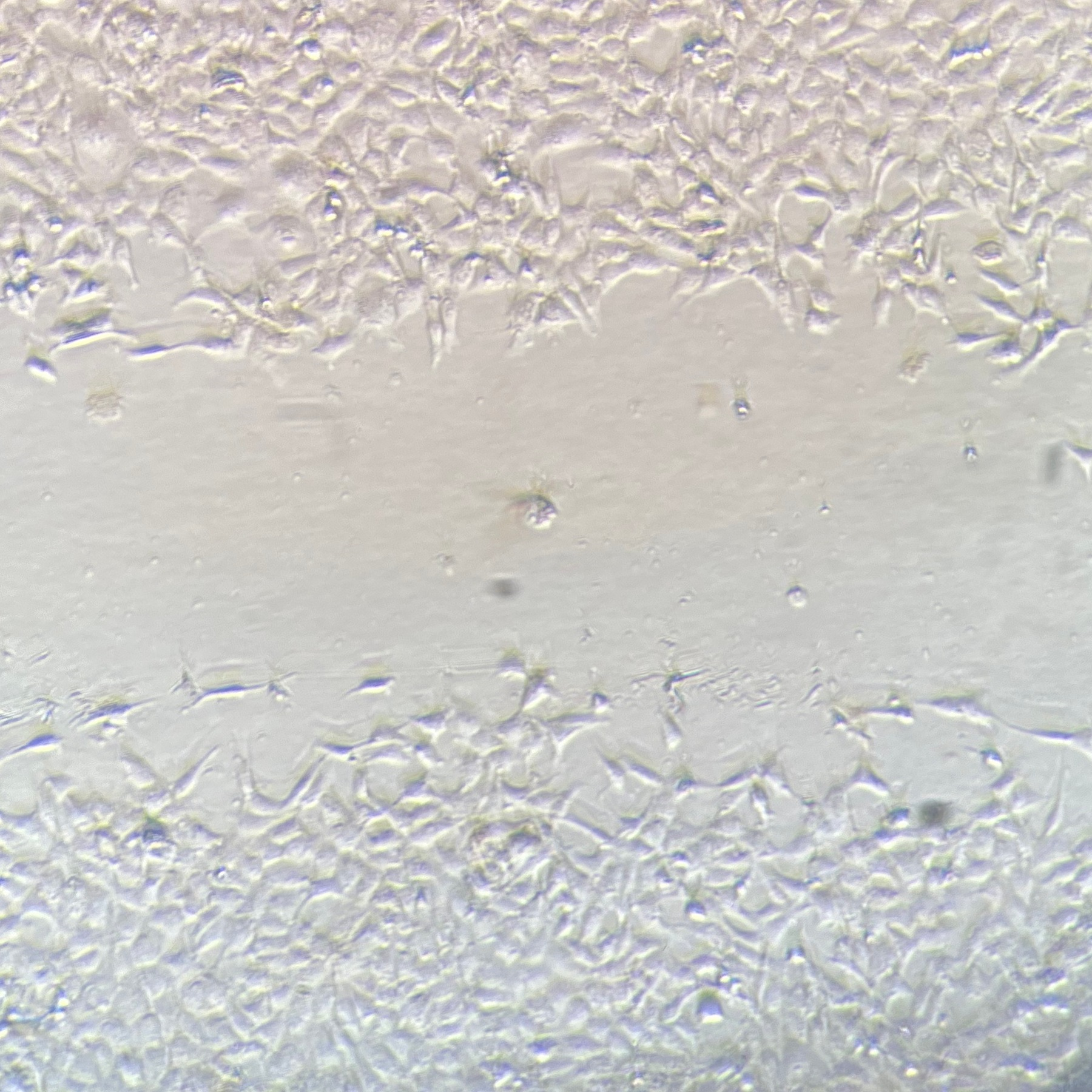 M8F 24 hour scratch assay image