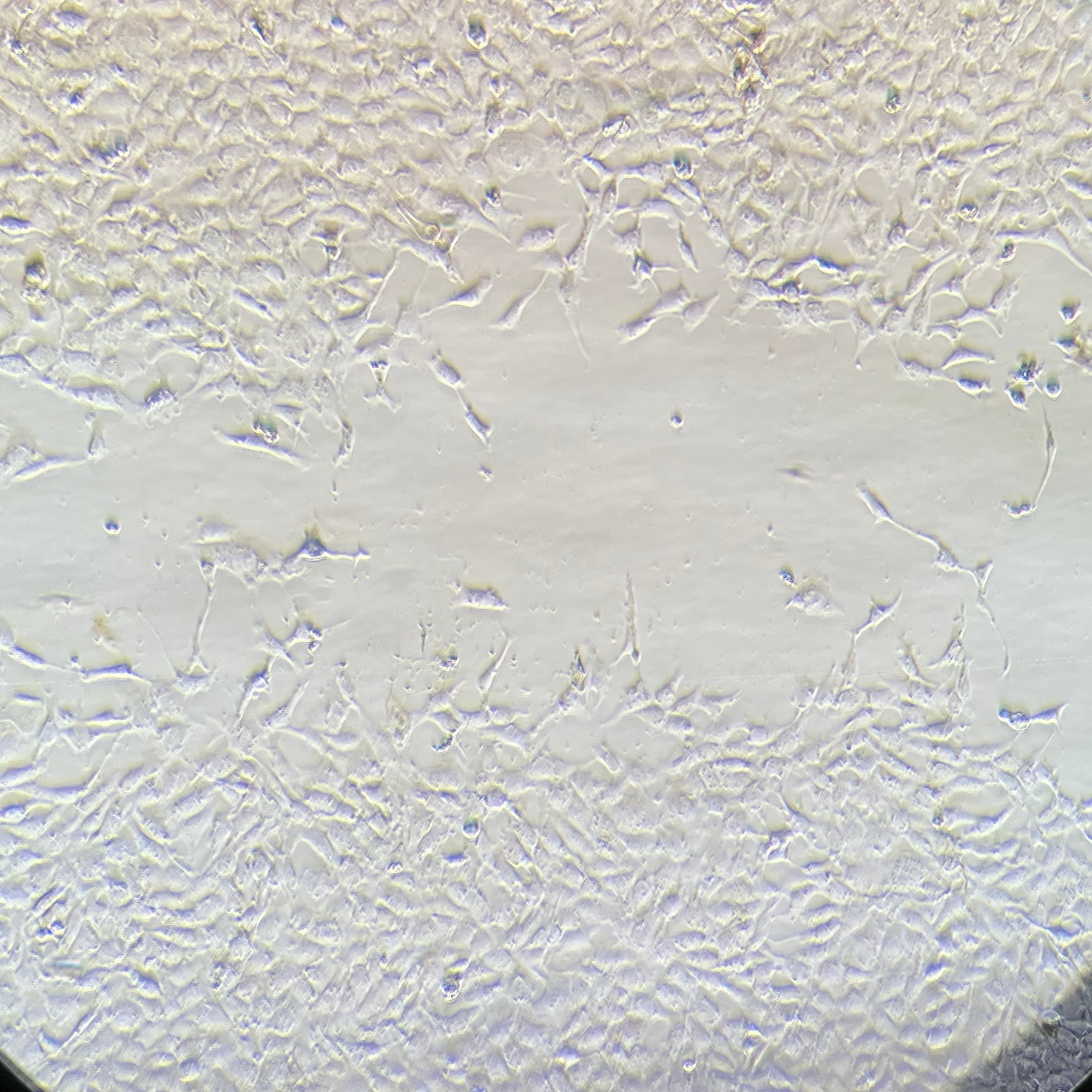 M8F 48 hour scratch assay image